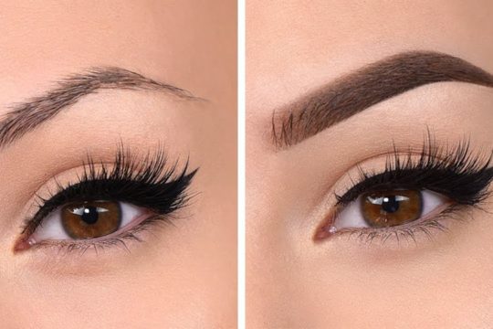 before_after_eye